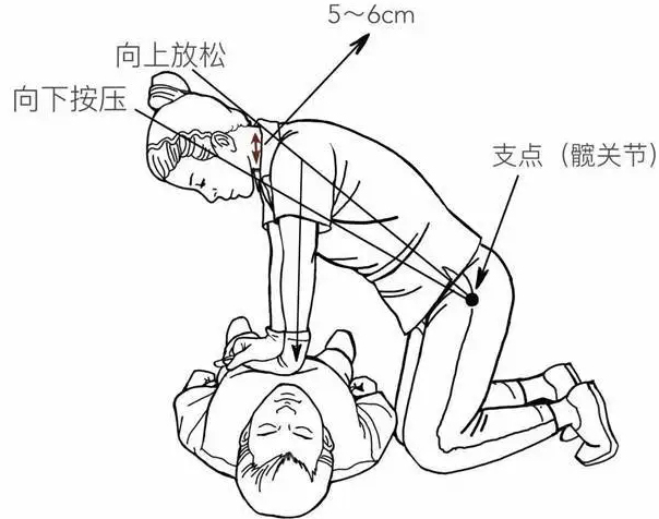 应急救护科普现场成人心肺复苏操作流程